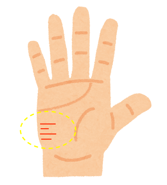 手相占い あなたの健康状態がわかる手相５選